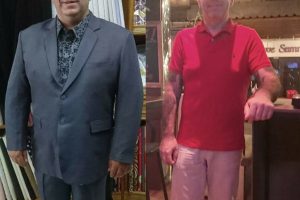 Bariatric-surgery-before-and-after4