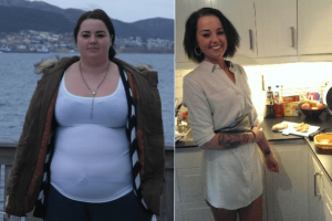 bariatric-before-after-1