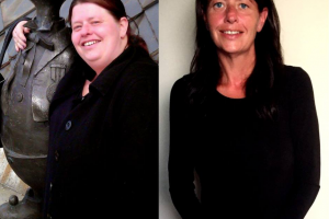 bariatric-before-after-6